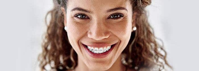 Get A Smile Makeover with Braces | Nowlin Orthodontics