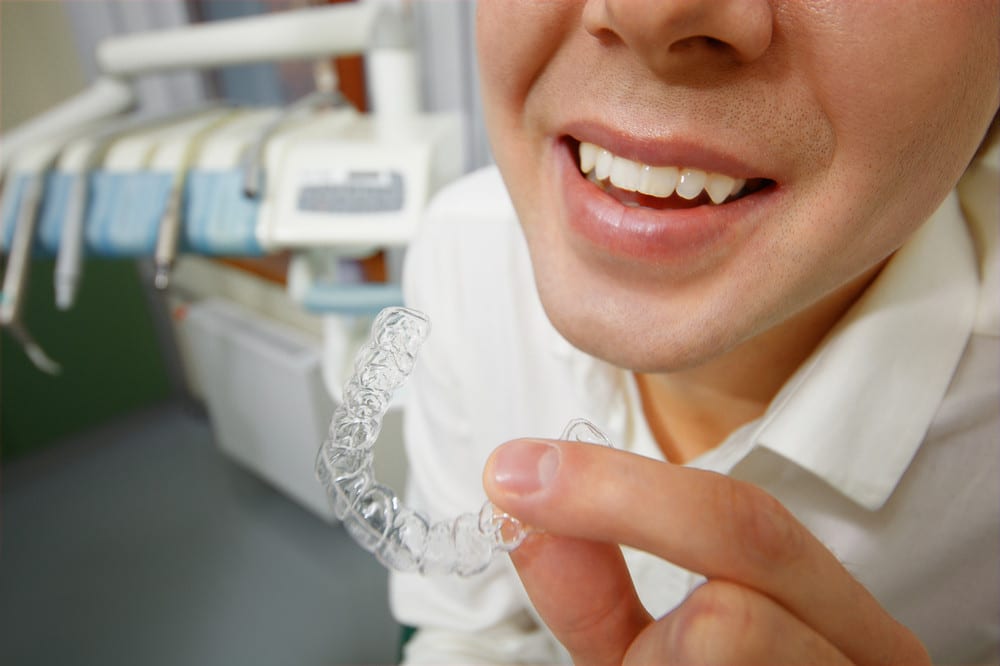 Retainers: What Are They & Why Wear Them?
