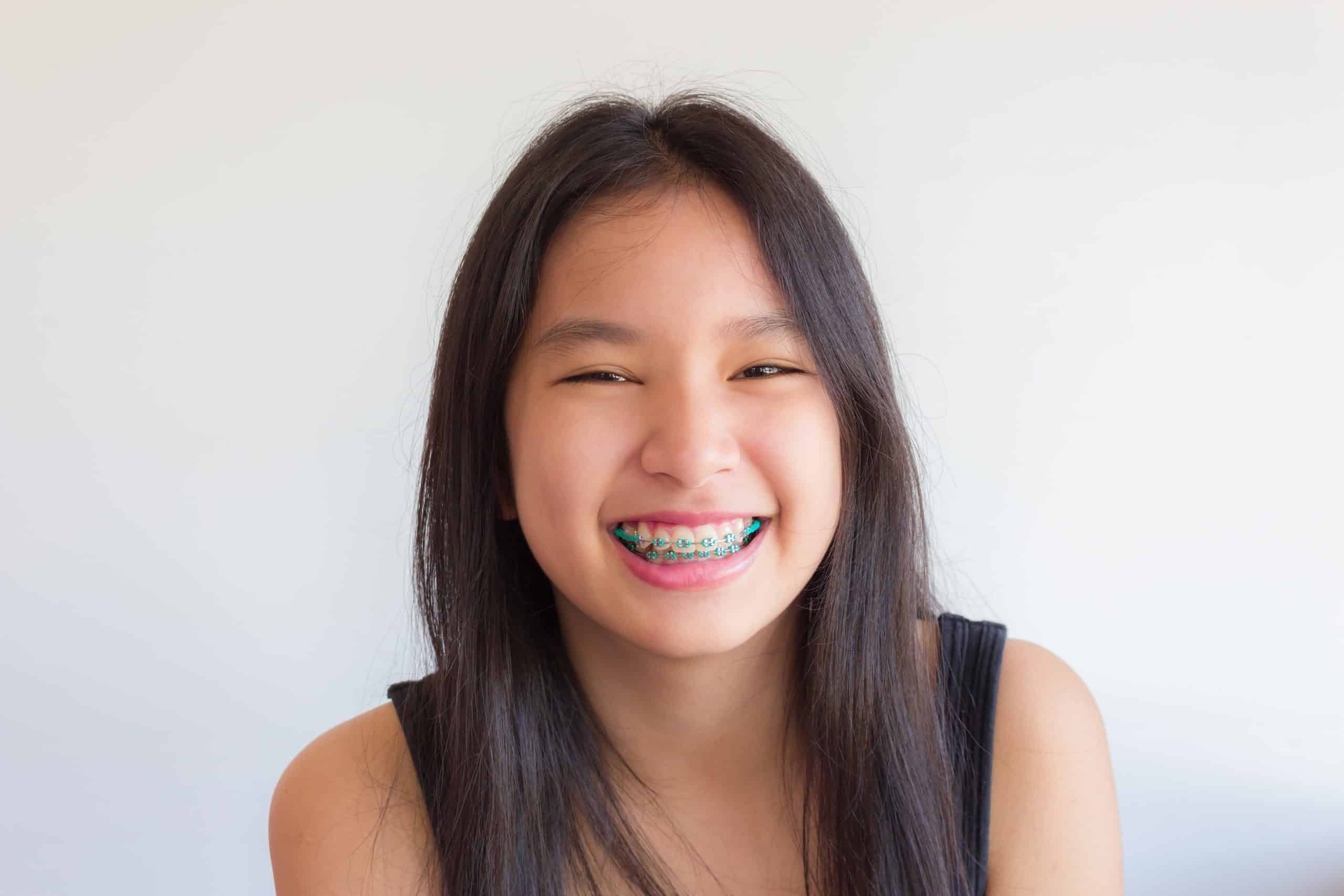 Asian Girl Has Braces And Shes Smiling Happily