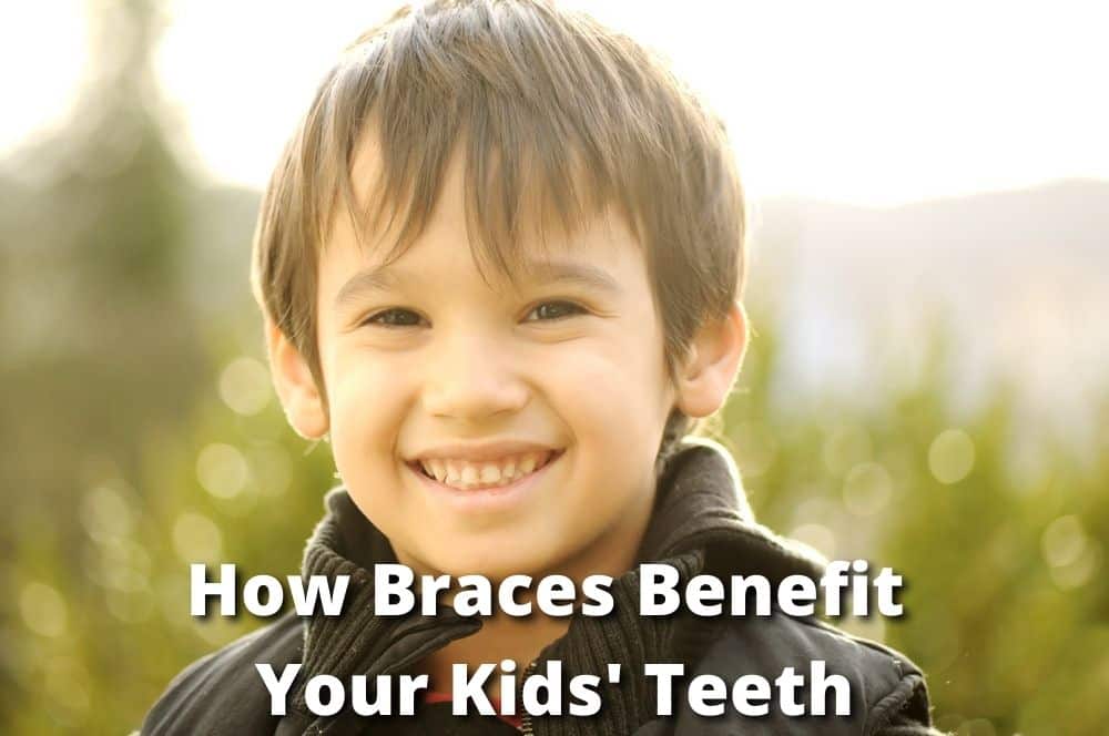 How Braces Benefit Your Kids’ Teeth | Nowlin Orthodontics Blog
