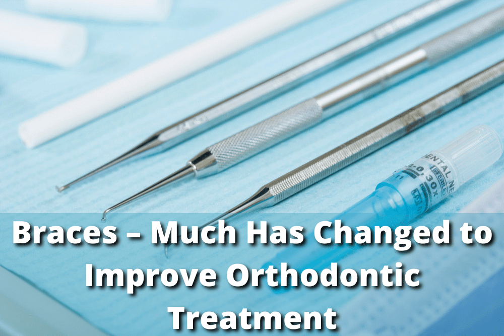 Braces - Changes Made to Improve Orthodontic Treatment