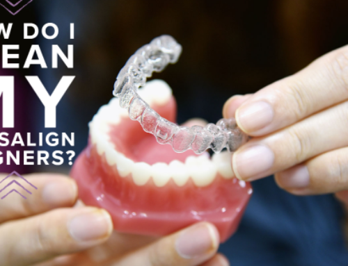 How Do I Clean My Invisalign Aligners?