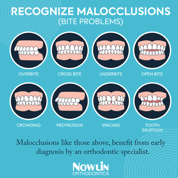 Recognize malocclusions