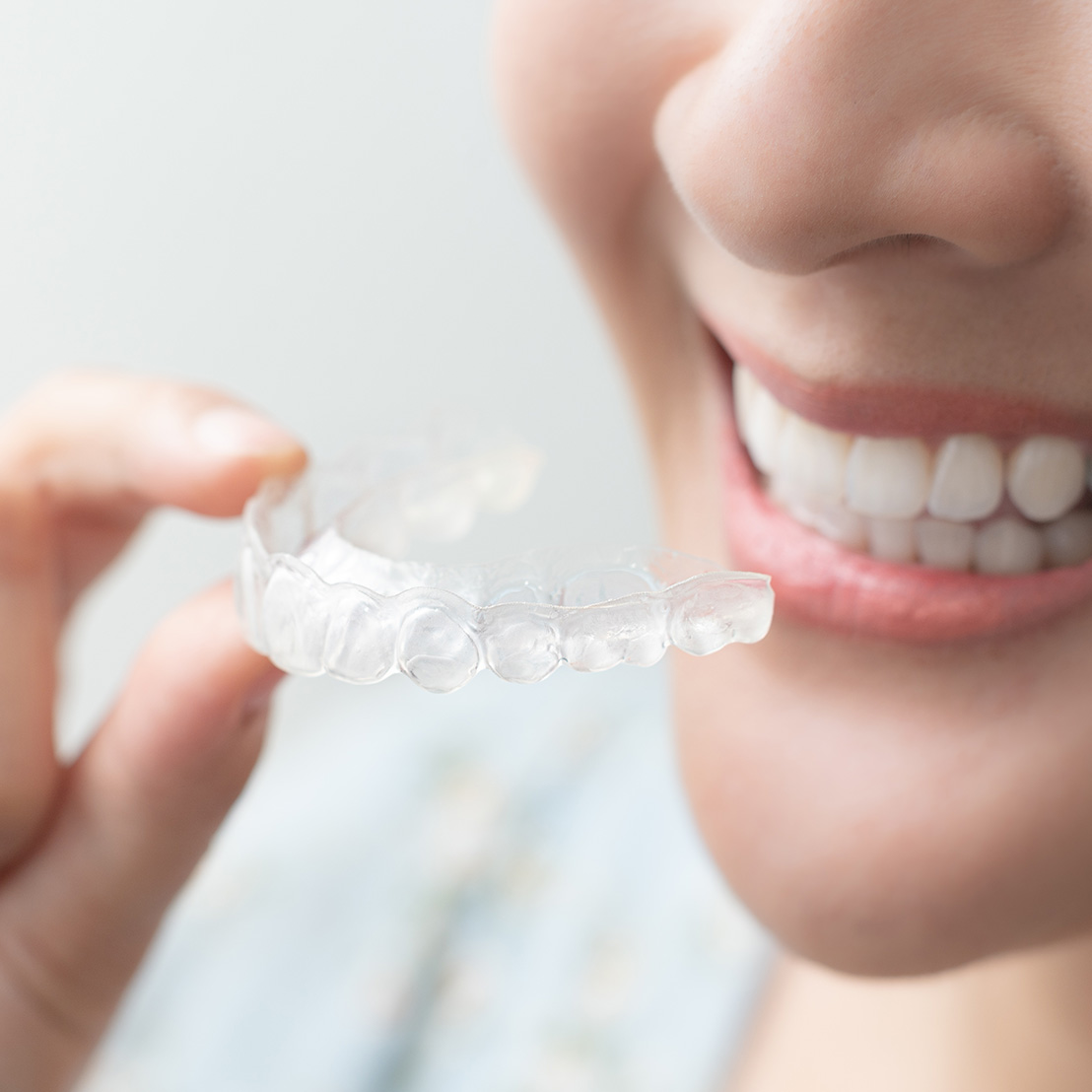 Cleaning Your Retainer: Dos and Don’ts 