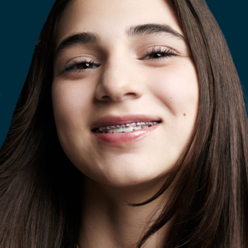 young girl with white teeth smiling with braces